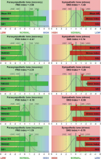 Primer prikaza natančne meritve frekvence srčnega utripa Primer prikaza natančne meritve frekvence srčnega utripa